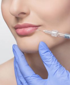 تزریق ژل لب در رازلیزر