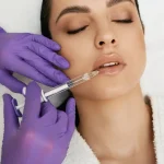 همه چیز درباره تزریق ژل لب؛ از مدل‌های محبوب تا عوارض احتمالی