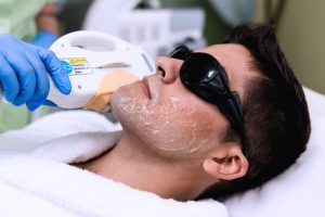 انجام لیزر در کلینیک رازلیزر
