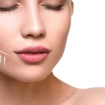 زاویه‌سازی صورت به سبک هالیوودی؛ راز چهره‌ای جذاب و خوش‌فرم در رازلیزر