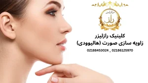 کلینیک رازلیزر زاویه سازی صورت (هالیوودی)