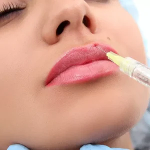 تزریق ژل لب در کلینیک رازلیزر