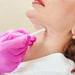 جوانسازی گردن؛ راز داشتن ظاهری جوان‌ تر بدون جراحی