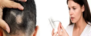 استرس باعث ریزش مو و پیری پوست در کلینیک رازلیزر