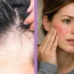آیا استرس باعث ریزش مو و پیری پوست می‌شود؟ بررسی کامل تأثیر استرس