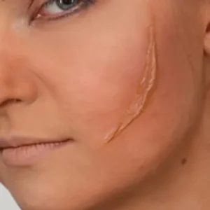 کلینیک رازلیزر رفع جای زخم