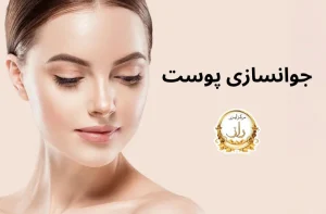 رازلیزر 