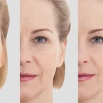 جوانسازی پوست چیست؟ بهترین روش‌های جوانسازی صورت | رازلیزر